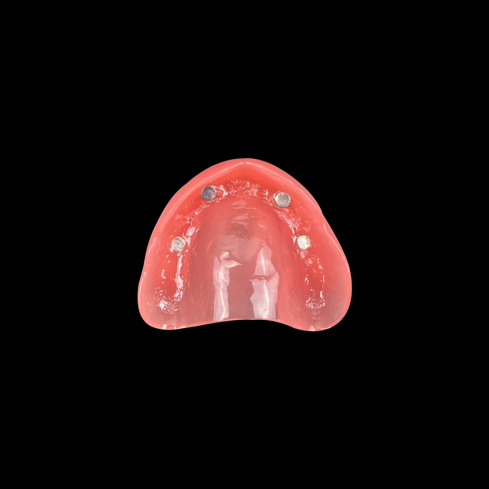 Dental Upper Overdenture Teeth Model Magnetic Adsorption Removable Superior Mandibular For Student Dentist Demo Study Teach