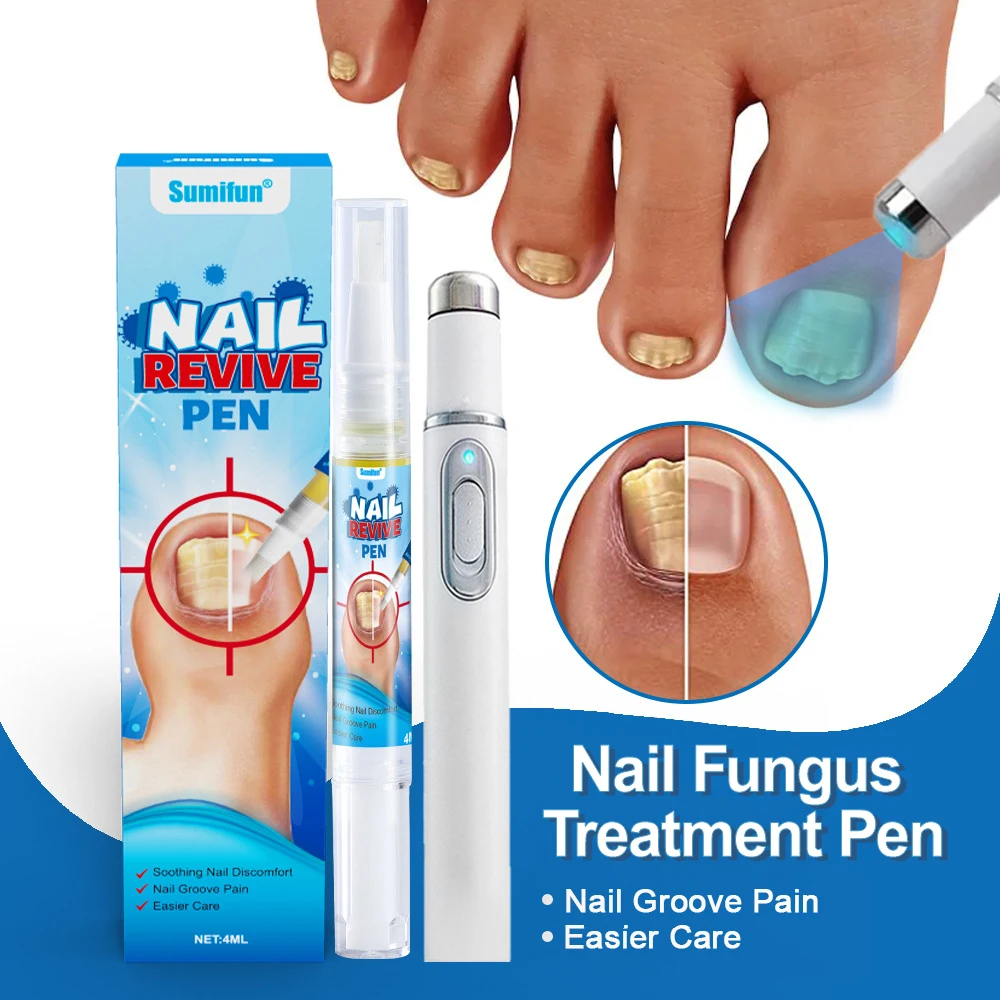 

Nail Fungus Laser Pen Nail Fungus Treatment for Toenail Pen Onychomycosis Paronychia Anti Fungal Laser Pen Removes Fungal Pen