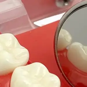 Anti Fog Rhodium Coated Dental Mouth Mirror Double Sided Reusable 5 or 10 Pcs for Oral Examination Use
