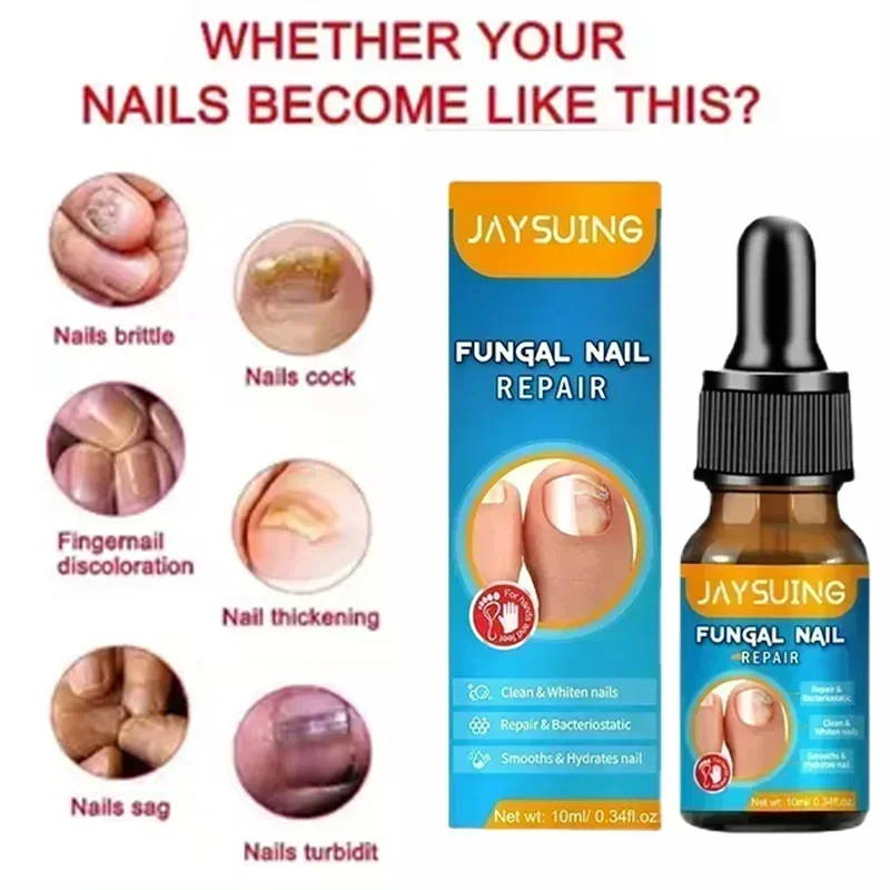 

Nail Fungals Renewal Nail Repair Liquid for Discolored Thickened Crumbled Nails Nail Fungals for Discolored Broken Cracked