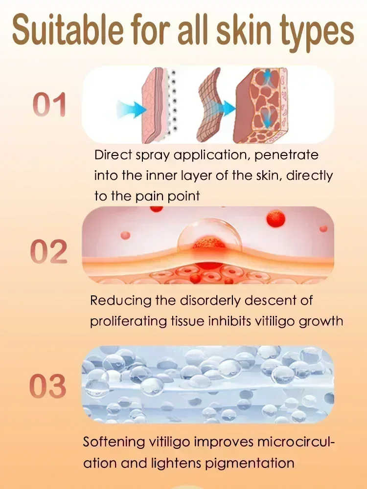 Ungüento de Vitiligo para eliminar eficazmente las manchas blancas de la piel, pomada para eliminar el Vitiligo, cuidado de la piel, 1006