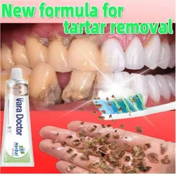 Whitening Teeth Toothpaste Dental Calculus Remover Mouth Odor Removal Bad Breath Preventing Periodontitis Teeth Oral Cavity Care