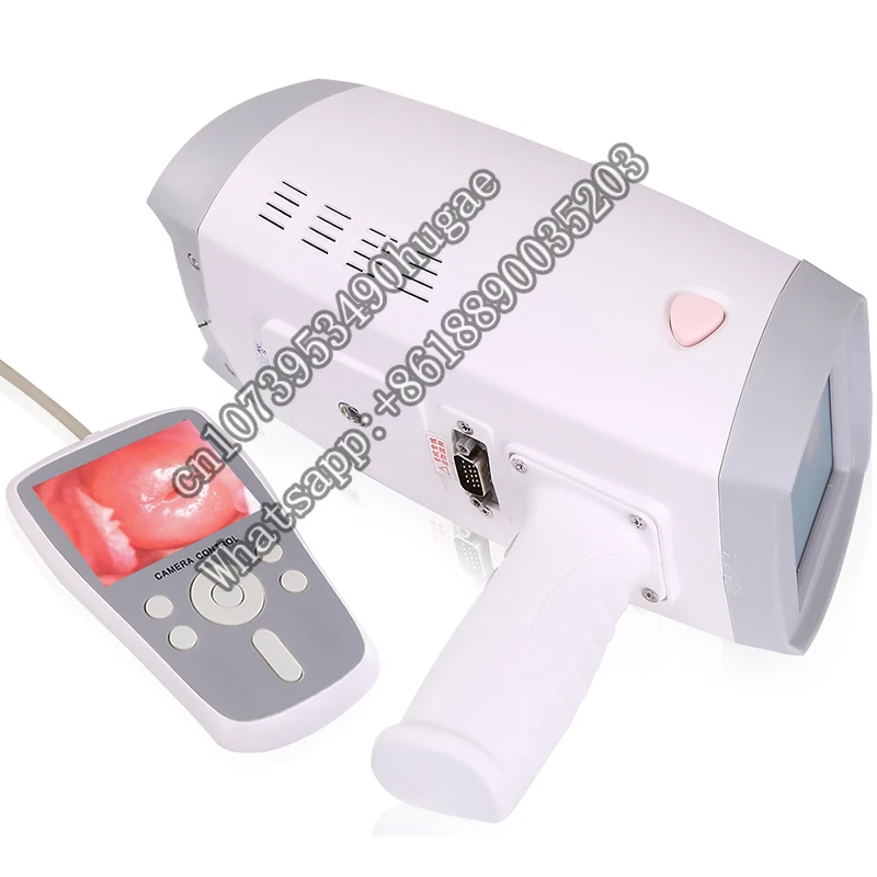 MY-F005 Medical Portable handheld electronic Video Colposcope for gynecology