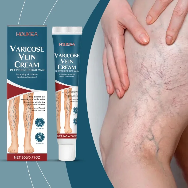 

20g Varicose Veins Treatment Cream Relief Cream Relieve Vasculitis Phlebitis Spider Swelling Earthworms Old Rotten Legs Health