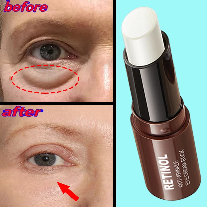 

Retinol Stick Anti-Wrinkle Eye Cream Get Rid Puffy Dark Circles Moisturizing Lift Fine Lines Whitening Health Repair Eye Care