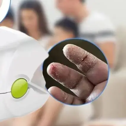 

Лазерное лечение грибка ногтей безболезненно, домашний прибор с инфракрасным светом 905 нм и синим светом 470 нм для эффективного восстановления ногтей