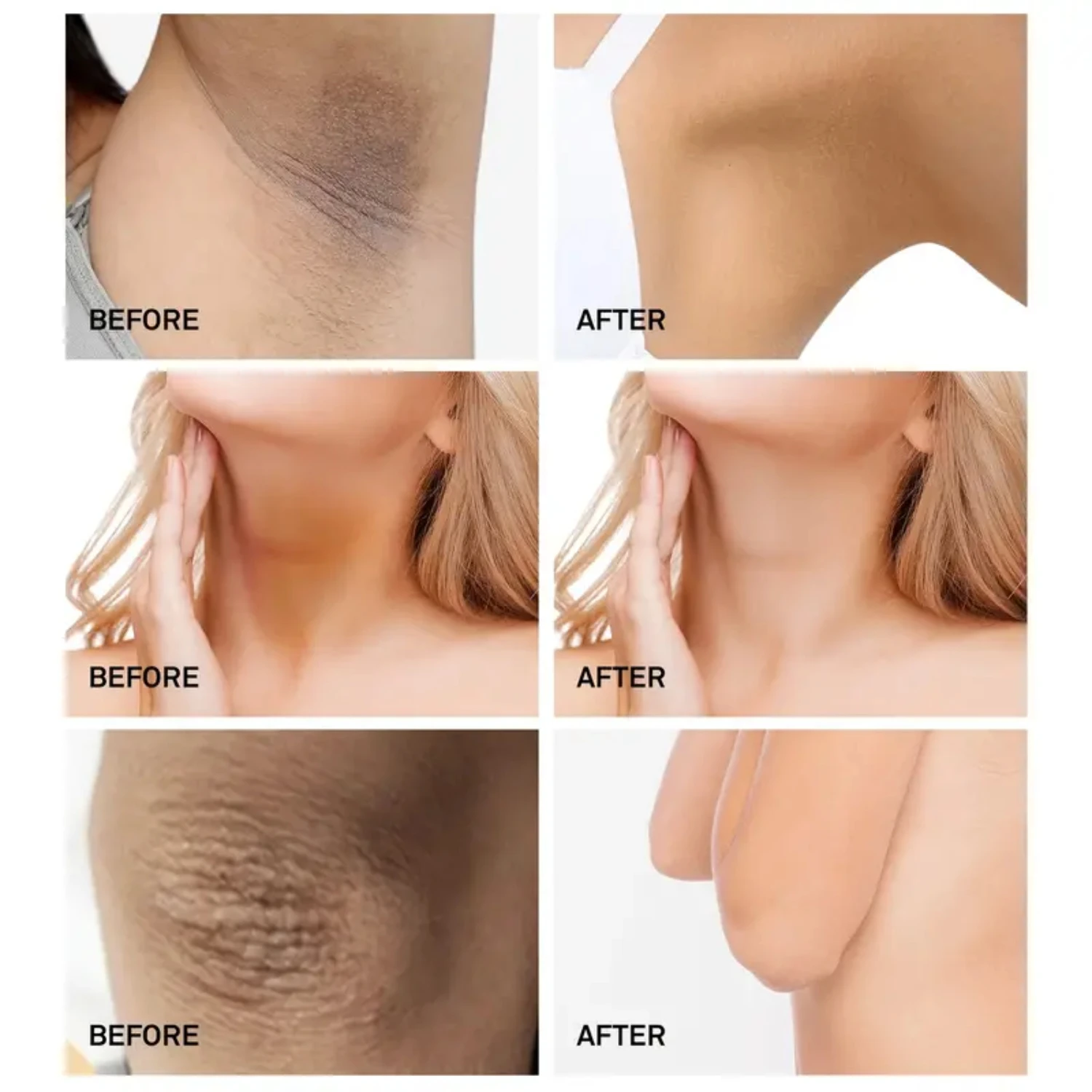 Crema nutriente e idratante per macchie scure per parti intime, ascelle, ginocchia e collo - Esperienza istantanea bella e radiante