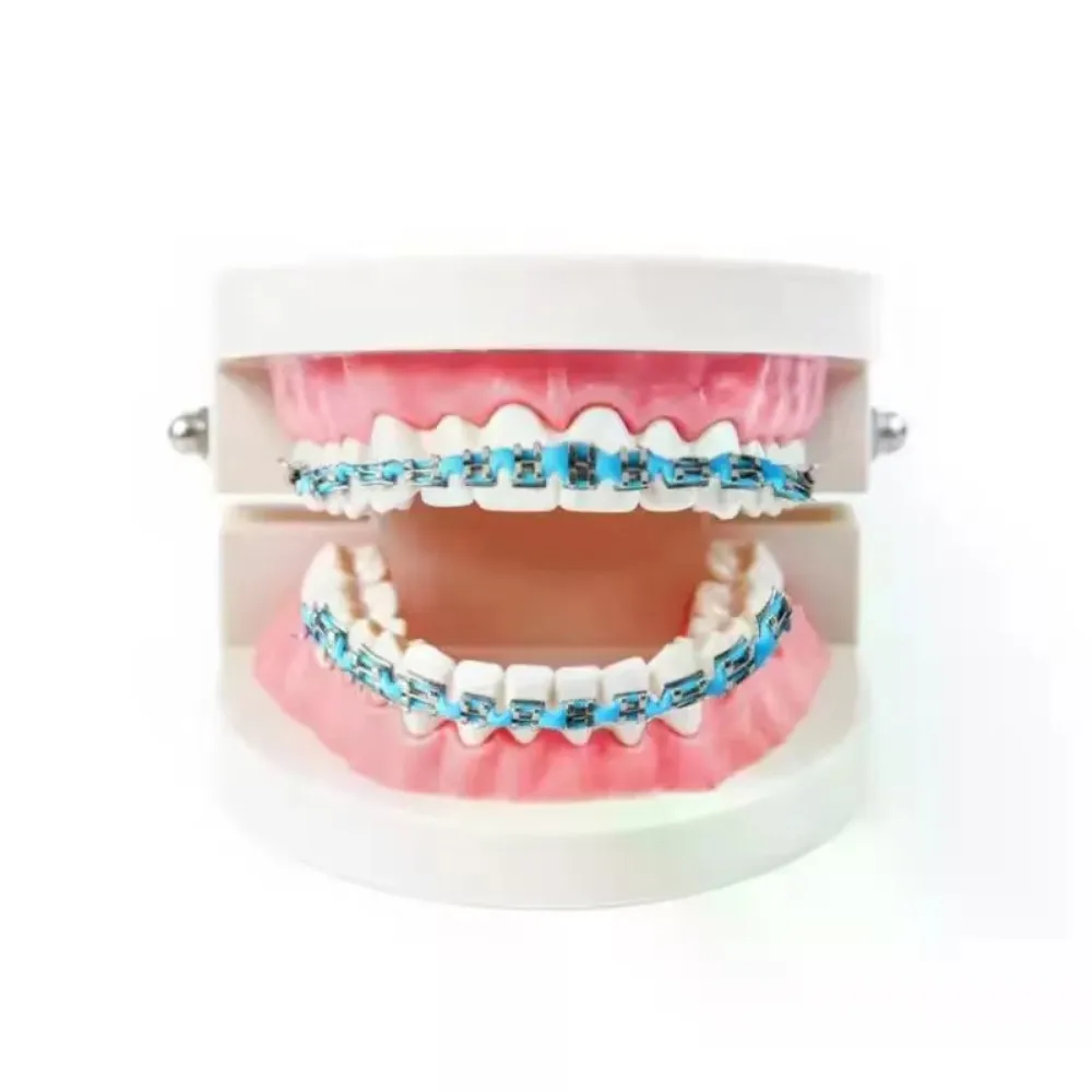 1 Pair Colorful Fashion Teeth Decorations Metal Wire Decorative Tooth Brackets Temporary Teeth Ornaments