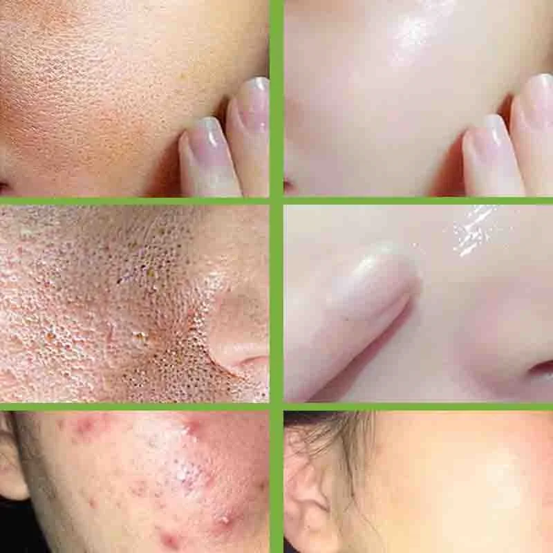 Eliminación de poros grandes, crema contracción de poros, reafirmante Facial, reparación, eliminador de poros faciales, minimiza el cuidado de la piel hidratante para mujeres