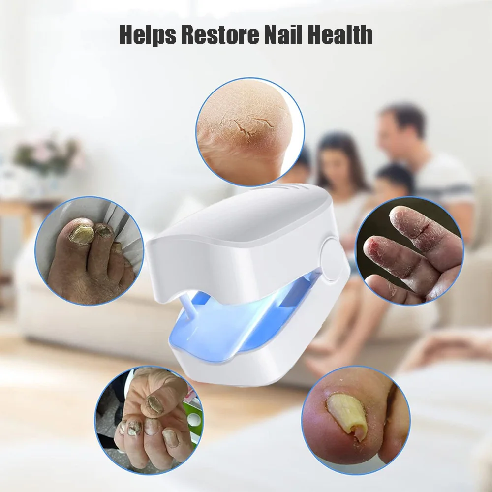 Mini Nail Fungus Laser Treatment Device Repair Toenail Fingernail Fungus Treat Onychomycosis Therapy Cure Effectively Remover