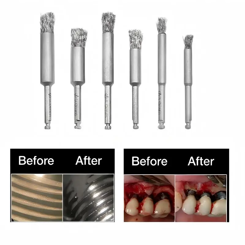 High Performance Dental Implant Debridement Titanium Wire Brush Set for Peri-Implantitis Care and Deep Cavity Cleaning