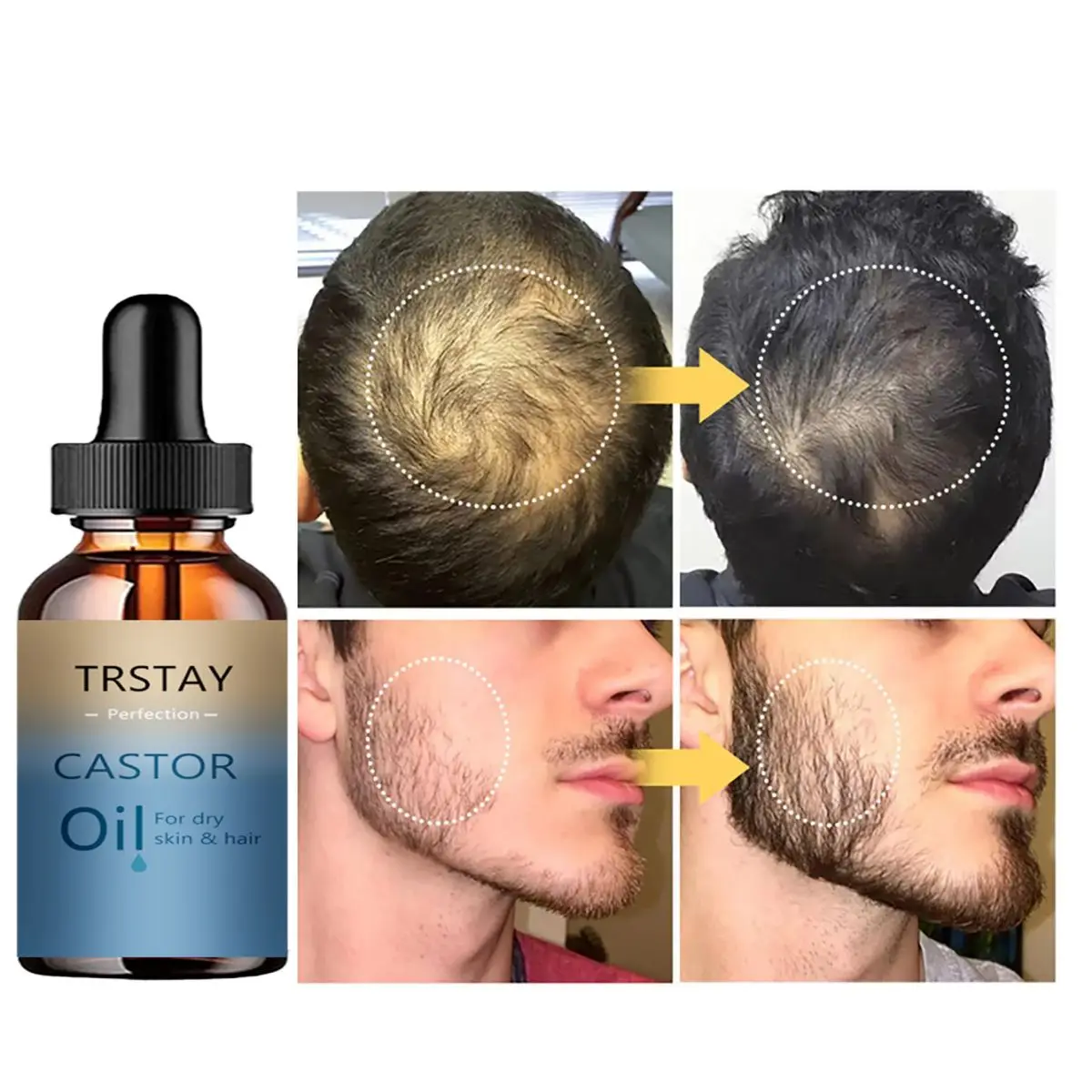 TRSTAY New Arrivals Eyebrow Growth Serum Essential Oils Eyelash Essence Castor Oil Beard Growth Essence Rapid Growth