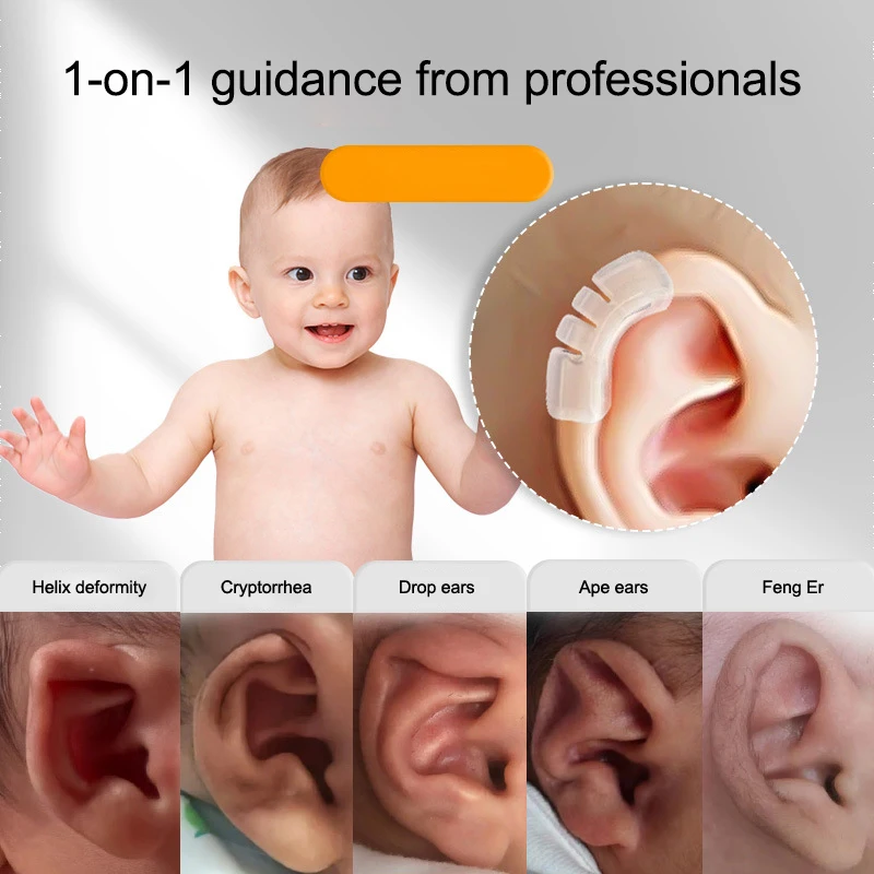 

Protruding Ear Support Infant Corrector Tools Silicone Auricle Correction Patch For Baby Ear Corrector Auricle Valgus Correction