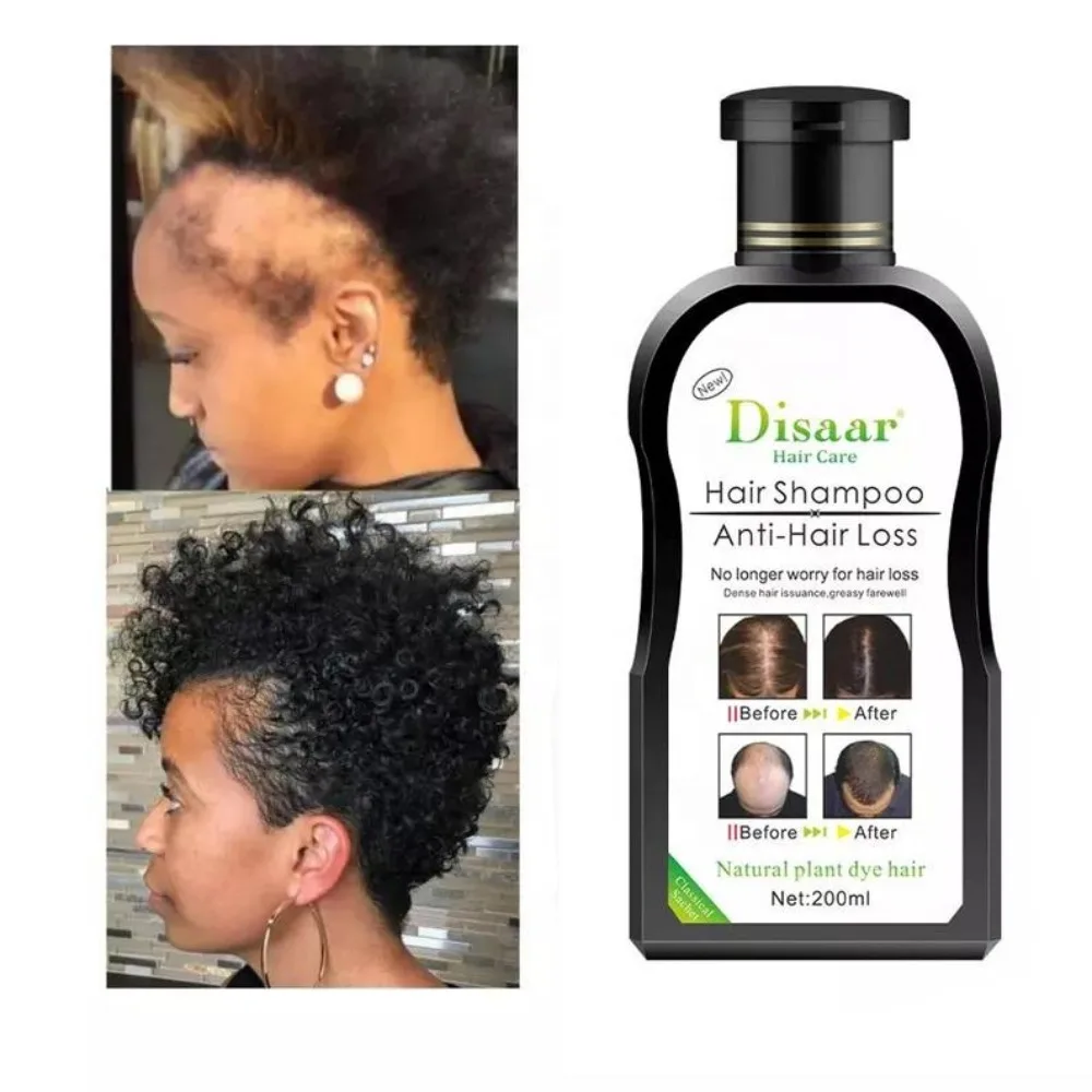 

200 мл Растительный шампунь для густоты, питания и защиты волос, укрепления корней, против выпадения, для жирных волос, придающий объем, 1 флакон