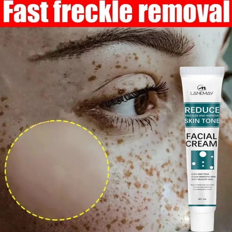 

Effective Whitening Freckle Cream Remove Dark Spot Cream Removal Melanin Melasma Lighten Brighten Anti-Aging Skin Care Products