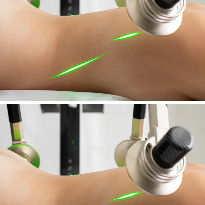 Green Light Therapy 6D Lipo Professional Body Slimming Machine Non-Invasive 532nm Lipolysis for Fat Removal Weight Loss