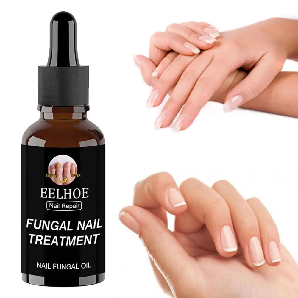 30ml/50ml Nail Nutrition Oil  Nail Treatment Cuticle Revitalizer Oil Prevent Agnail Nail Polish Nourish Skin