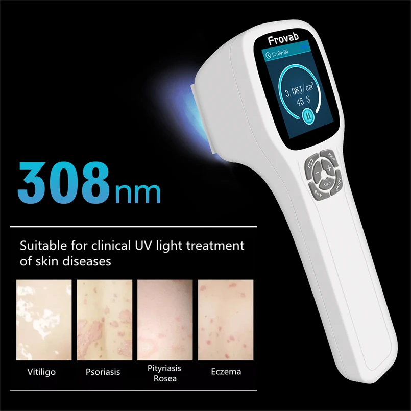 

Advanced Phototherapy UVB Light 308nm Vitiligo Treatment Device Blue Light for Pimples Eczema Safe Therapies No Side Effect