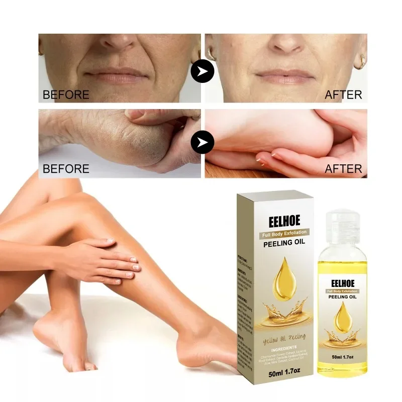 Minyak pengelupas kuning, penghilang pemutih lengan siku kaki lutut Melanin gelap badan bersih mencerahkan pengelupasan kulit mati Serum pemutih