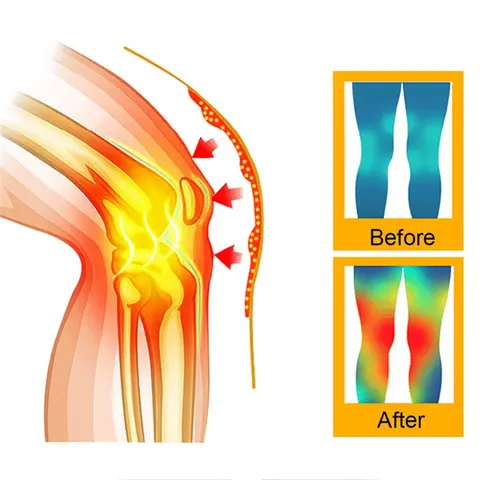 2 पीस नए सेल्फ हीटिंग नी ब्रेसेस स्लीव टूमलाइन नी सपोर्ट सुदूर इन्फ्रारेड गर्म घुटने पैड रखें 10 best sales पैर का सहारा - №8