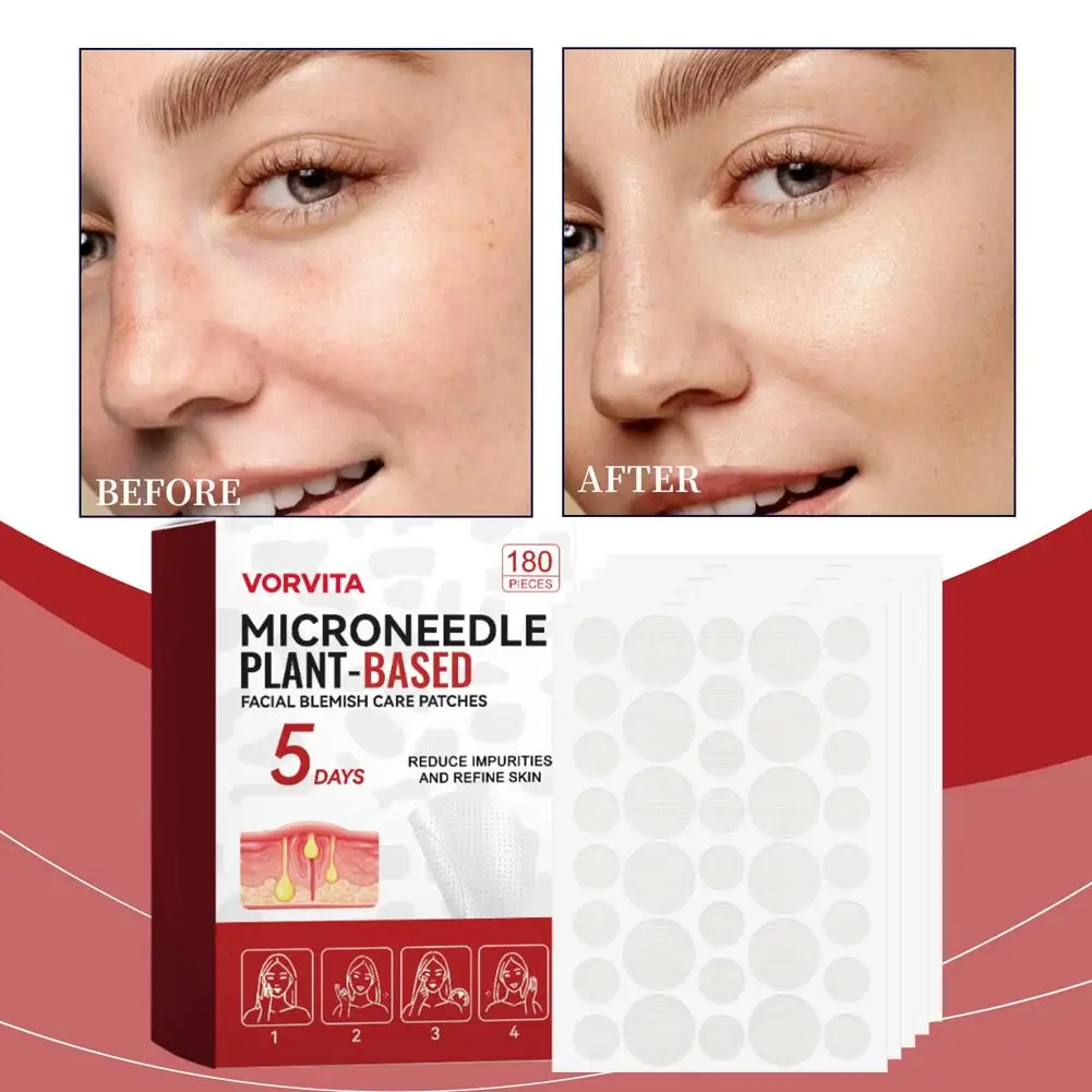 180pcs 0.2mm Facial Soothing Microneedle Patches Acne Care Patch Facial Skin Care Imperfection Patch 2026 Nerw image 5