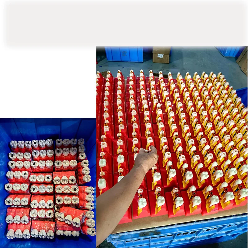 Modello di sviluppo delle carie dentali Modello dentale Modello di disintegrazione delle carie Multiplicazione quadrupla a 3 fasi