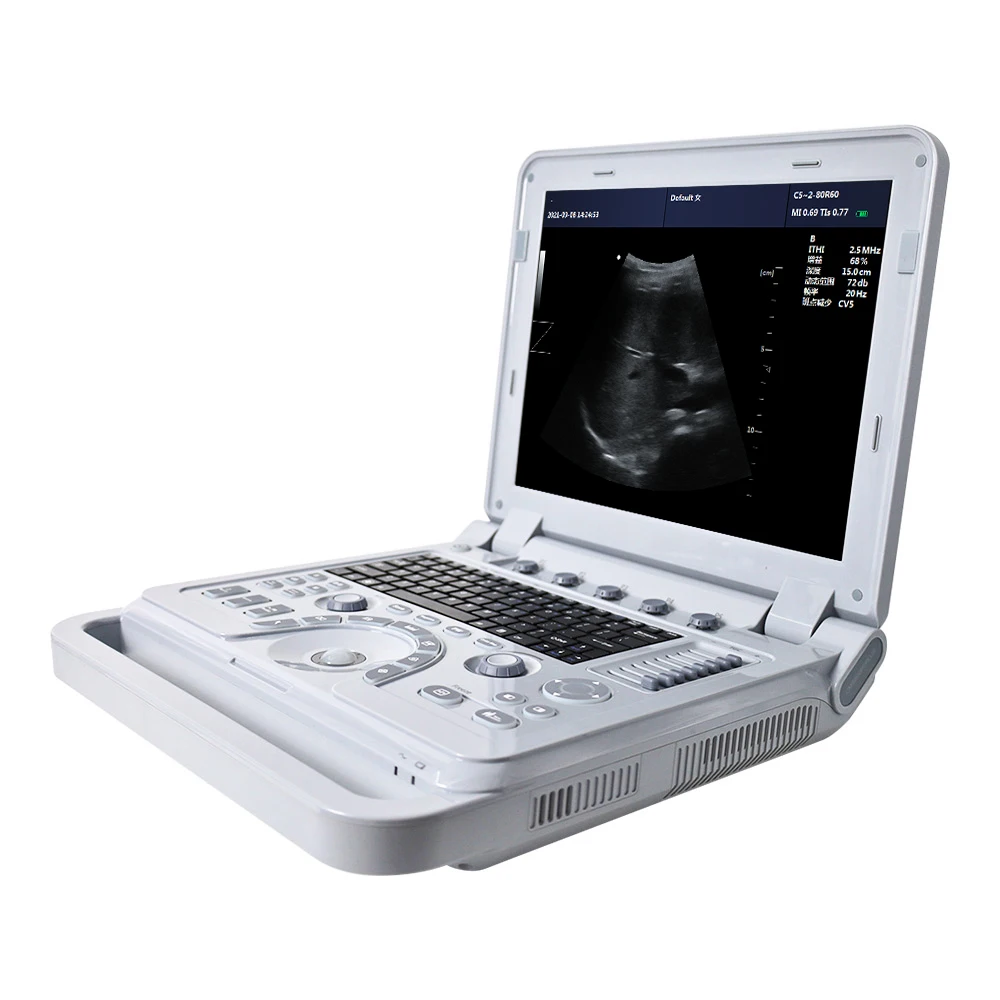 CONTEC CMS600P2 PLUS ultrasound pseudo color doppler ultrasound Pulse Spectral ultrasound