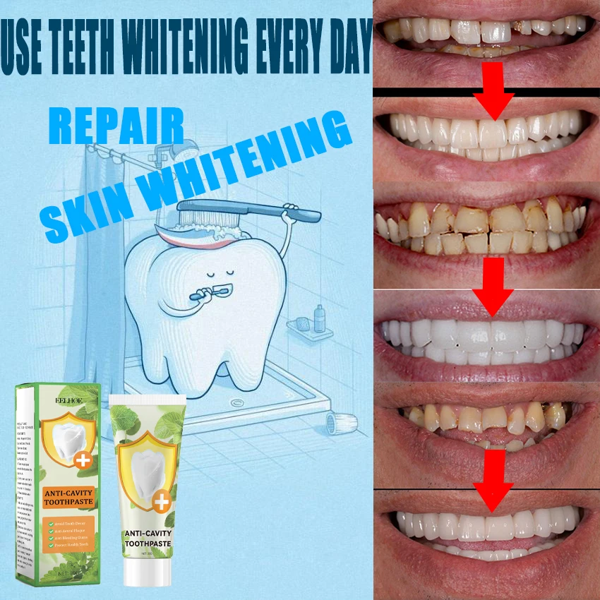 

Быстрое удаление пятен дыма Зубная паста Удаление пятен налета Гигиена полости рта Чистка Свежее дыхание Инструменты для отбеливания зубов Уход за полостью рта