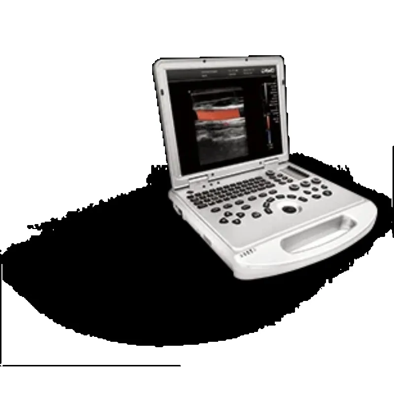 Dawei DW-L3 Color Ultrasonic Diagnostic Apparatus portable ultrasound machine for OB/GYN