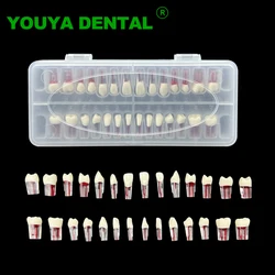 28pcs/set Dental Endodontic Teeth Model Full Mouth Root Canal Block Training Tooth Pulp Cavity Study Model Dentistry Products