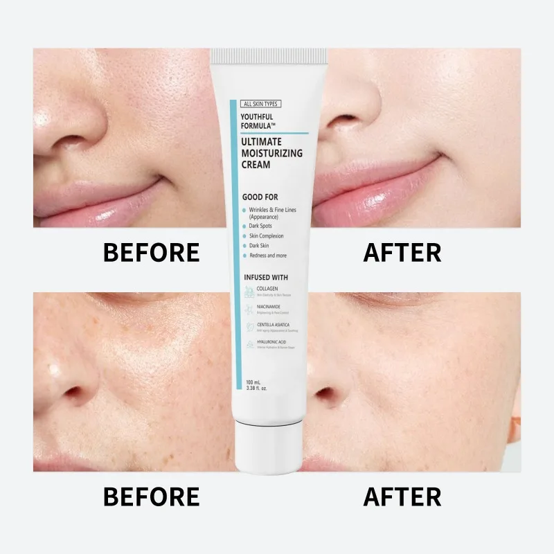 Ultimate Moisturizing Cream for Face with Centella, Niacinamide, Barrier Protection Moisturizer Cream for All Skin Types