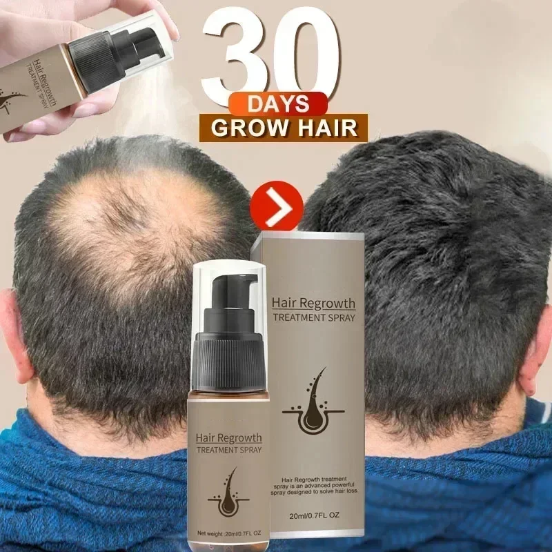 Suero para el crecimiento del cabello en aerosol, productos de tratamiento antipérdida de jengibre, reparación, nutre las raíces del cabello, crecimiento rápido de los pelos y la barba