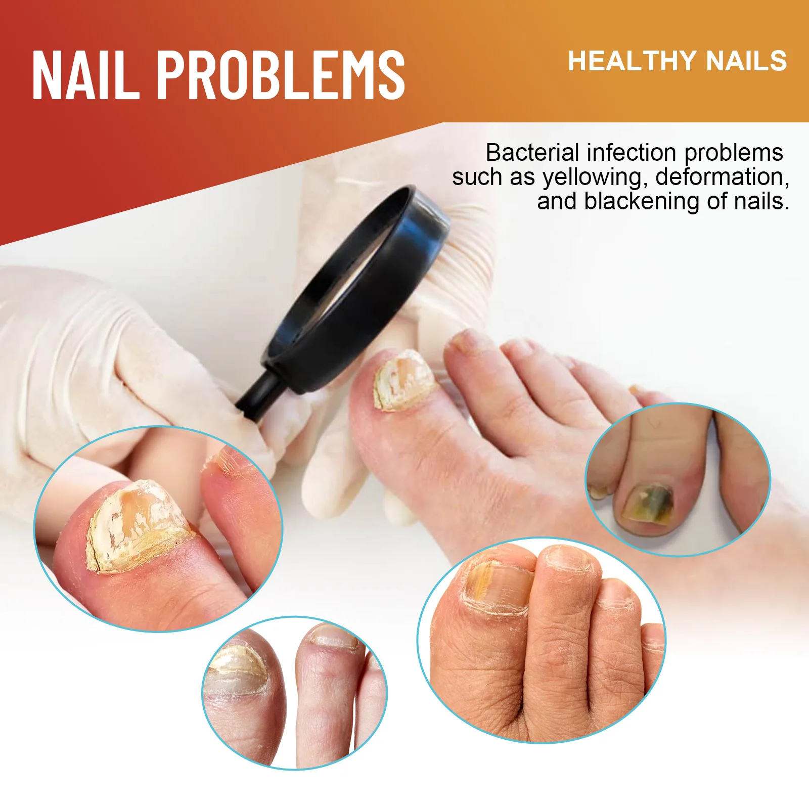 Fungal Nail Repair Patches Anti Fungal Nail Correction Reduce The Yellowing Deformation Of Nails Protect Nails Feet Care Tools
