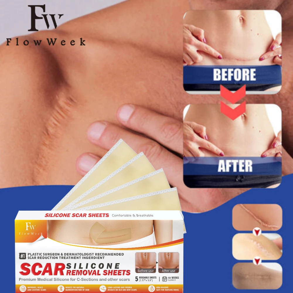 

Flow Week Scar Silicone Strips Professional Scar Removal Sheets Effective Scar Removal Strips for C-Section Keloid Surgery Burn