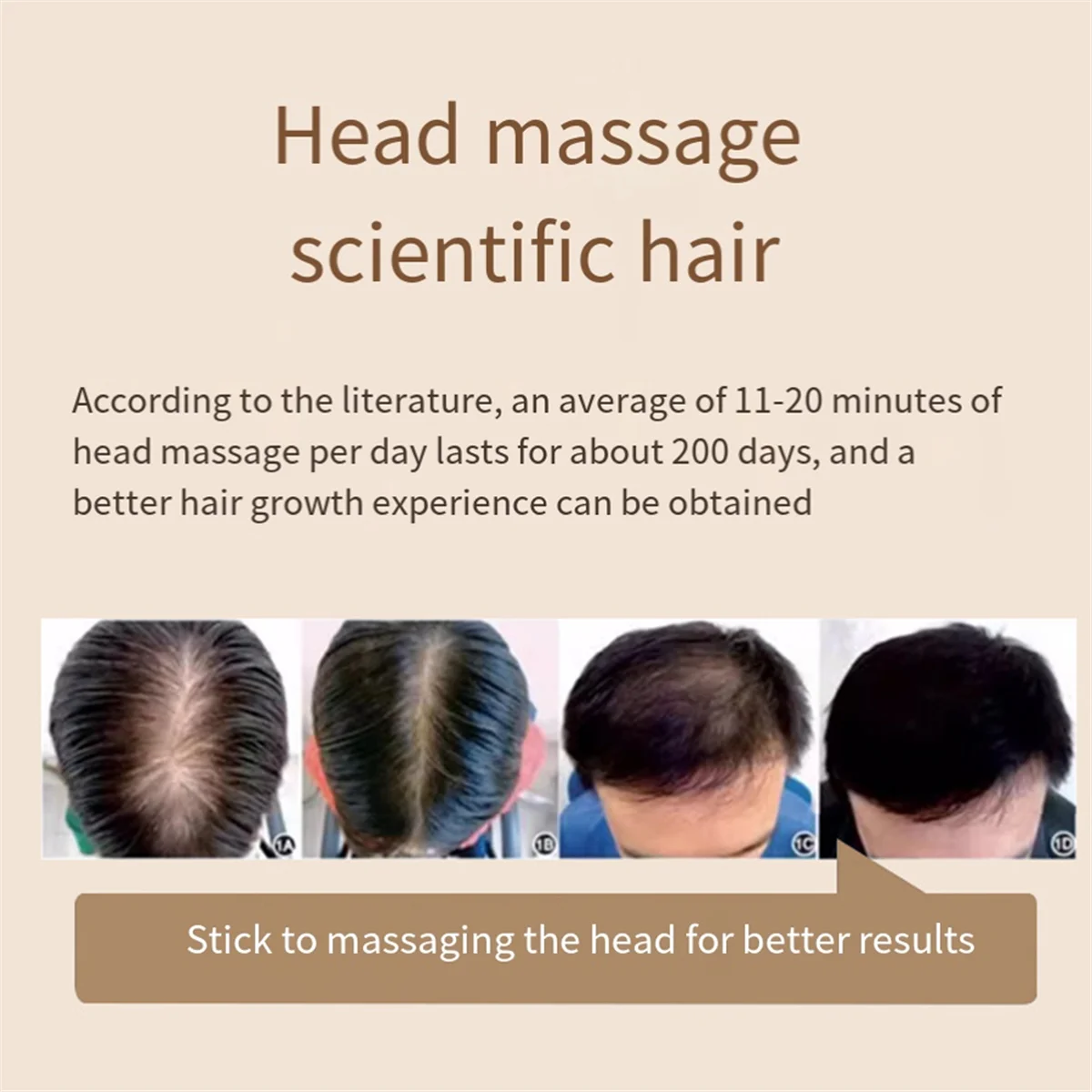 FZFZ 전기 두피 마사지기 및 헤어 오일 어플리케이터, 헤어 트리트먼트 성장을 위한 헤어 마사지기 두피 어플리케이터 브러시