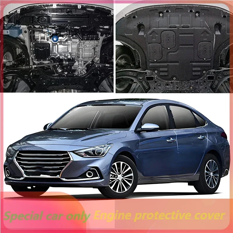 

Higher Quality Black Under Engine Guard Mudguard Board Splash Shield Mud Fender Plate Panel For Hyundai Celesta 2017-2020 1.6L