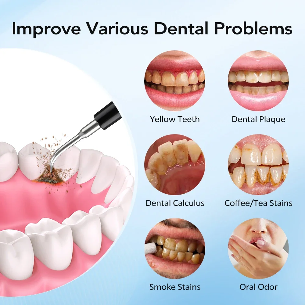 Electric Sonic Vibration Dental Scaler Teeth Whitening Plaque Calculus Coffee Smoke Stains Tartar Removal Toothbrush Tooth Clean view 5