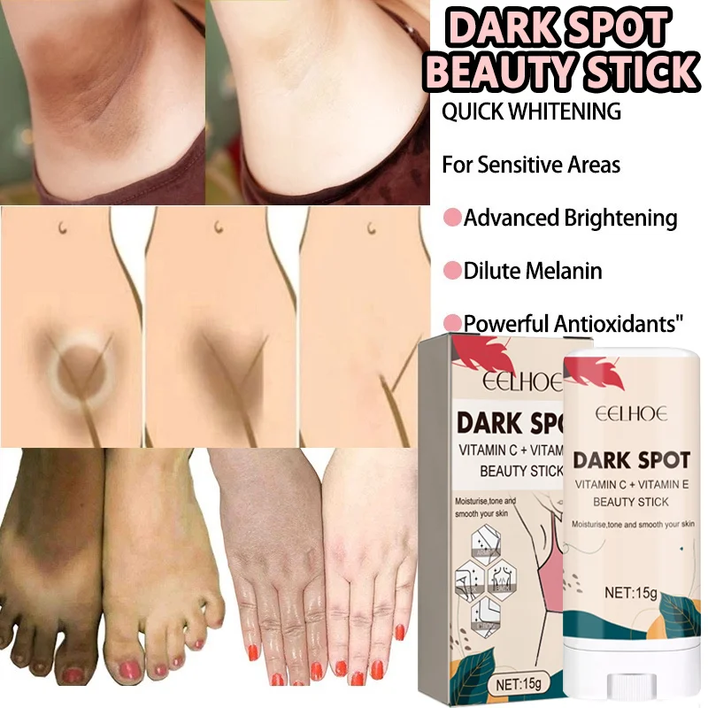 

Dark Spot Beauty Stick Cream Elbows Hand Knuckle Brightening Revives Dull Skin Nourishes Skin Whiten Dark Knuckles Fast Brighten