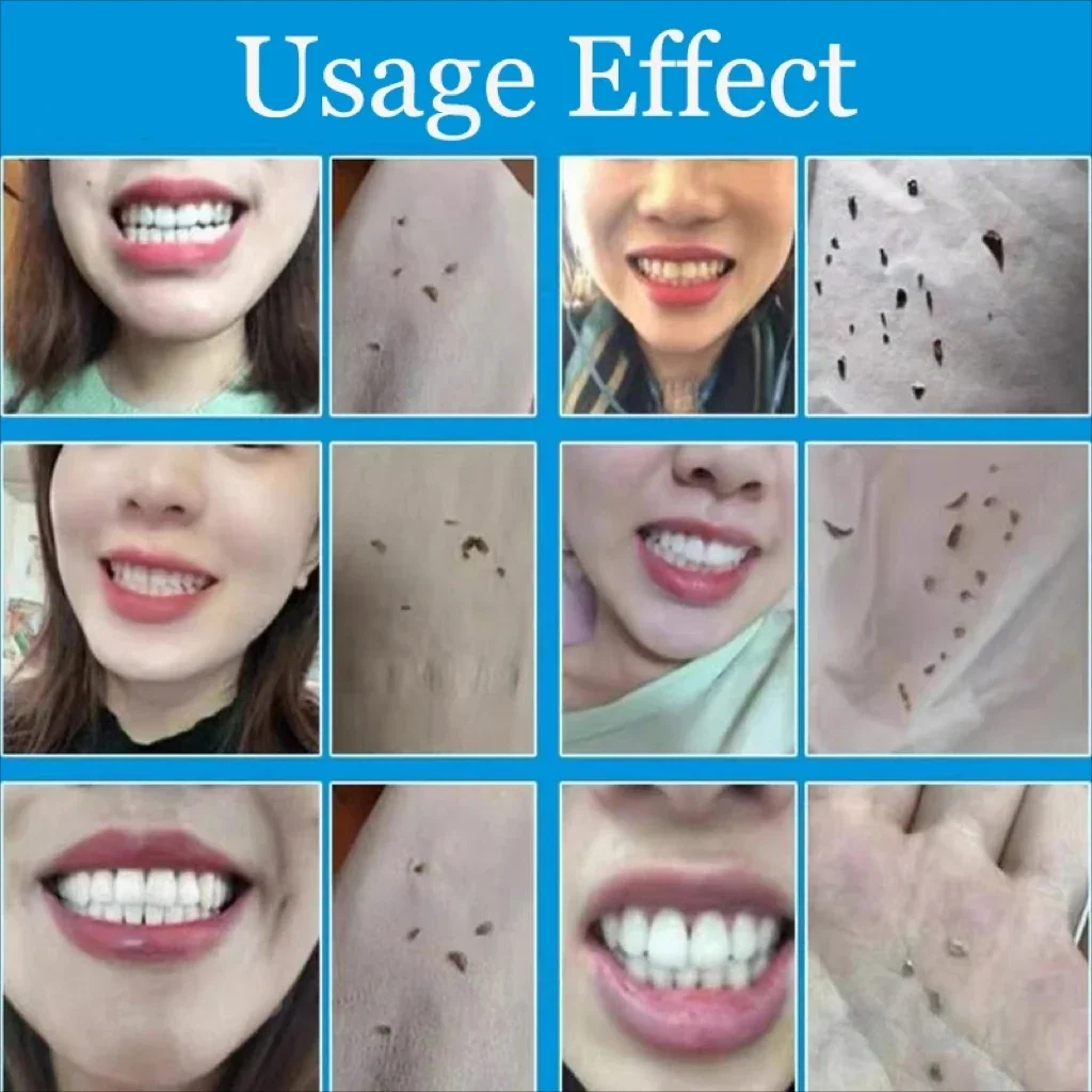 Dental Calculus Remover Spray Teeth Whitening Serum Remove Plaque Stains Halitosis Cleaning Oral Hygiene Fresh Bad Breath Care