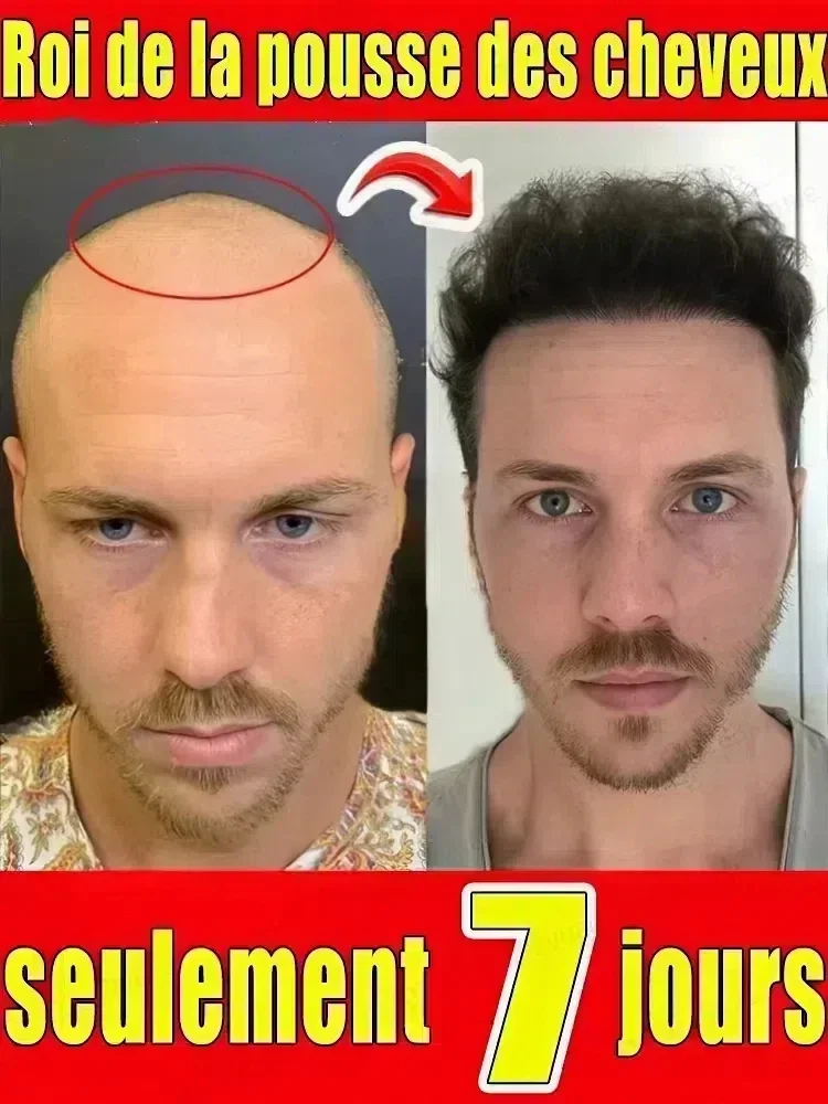 

Hair Growth Essential Loss Regrowth Treatment Strengthens Hair Nourishes Scalp Light Weight Non Greasy Improve Scalp Circulation