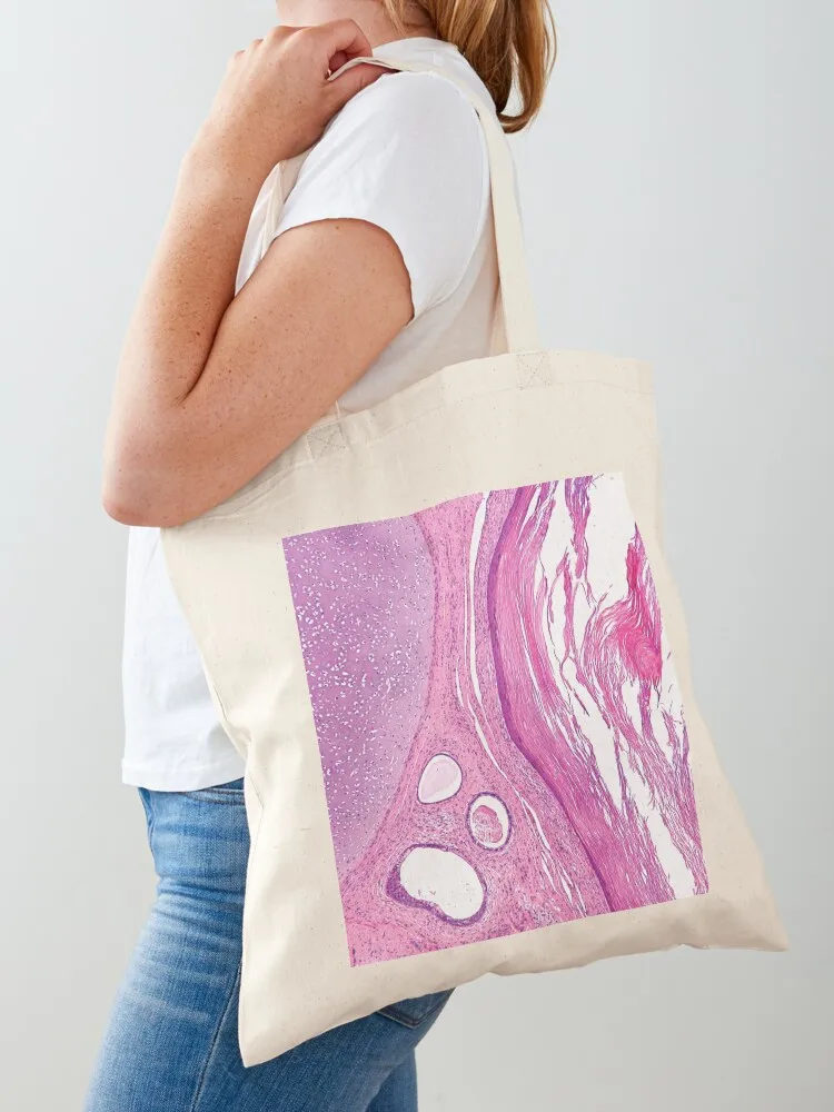 

Teratoma Histology Tote Bag Women's shopping bag canvas tote bags Women's bag custom tote