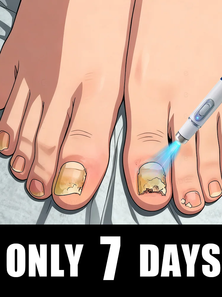 

Laser treatment for nail fungus and removal of onychomycosis