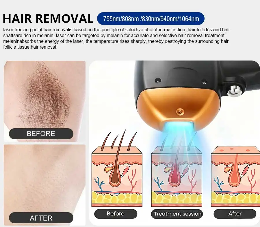 5 Wavelength Diode Laser Hair Removal Machine FAC Technology Genuine Sapphire Ice Cooling Painless Permanent Hair Remover Salon