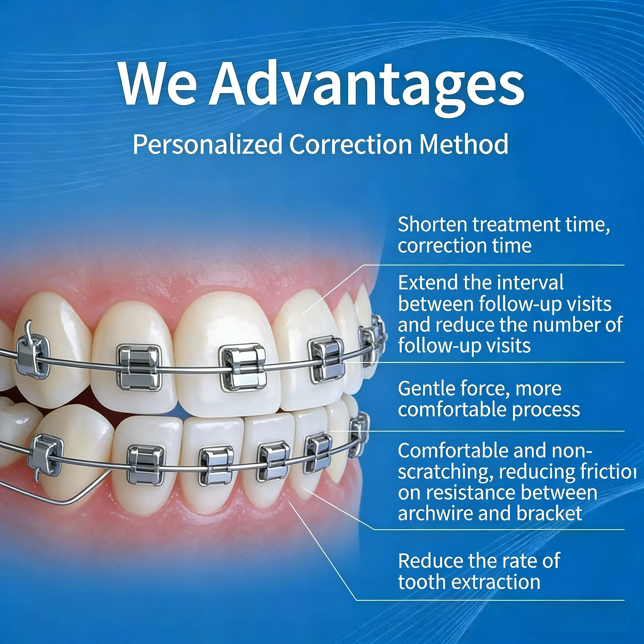 1 Box Dental Xihu Bar Passive Self-Ligating Orthodontic Brackets, Excellence Gen 3 Metal Brackets for Teeth Straightening.