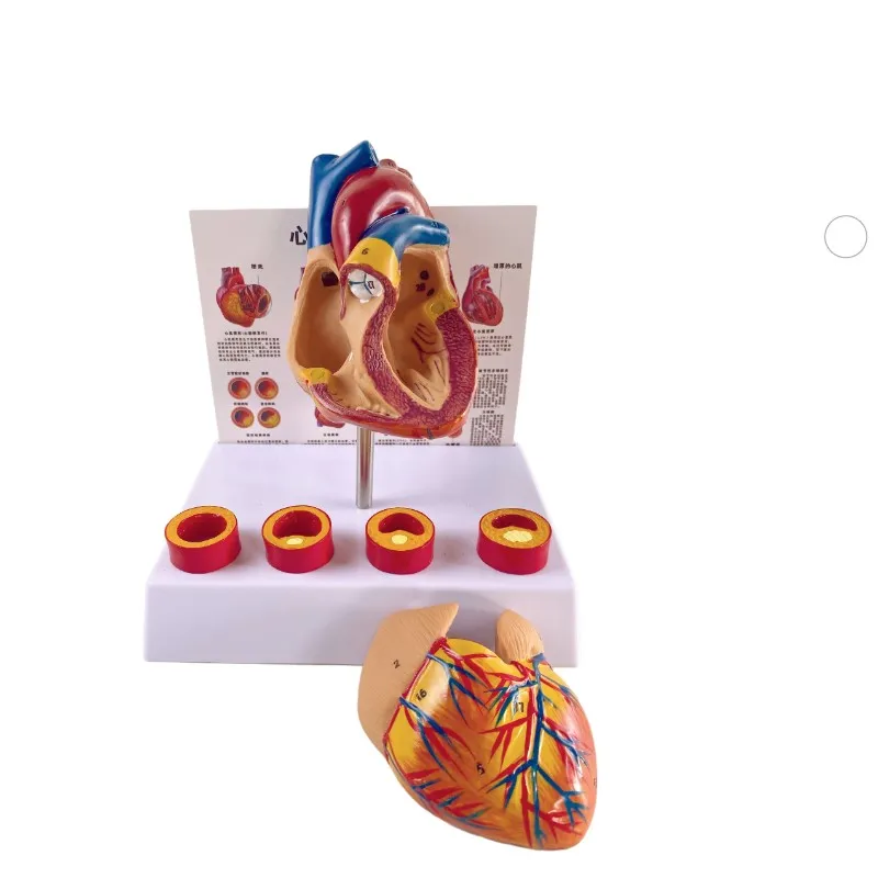 Removable Anatomical Human Life Size Heart Medical Cardiovascular Anatomy Thrombotic Vascular Model 18x14x23cm