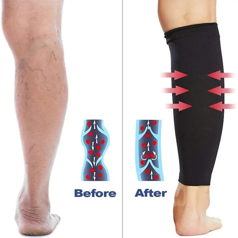 2Pcs 20-30 mmHg Graduated Calf Compression Sleeves Calf Support Footless Compression Socks for Varicose Veins Shin Splints Edema