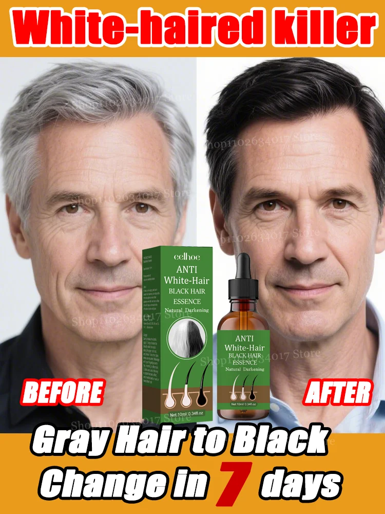 Natural Anti Gray Hair Serum | Nourishing Hair Care Remedy - Repair White & Darkening Hair