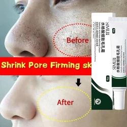 Salicylic Acid Pores Shrink Refining Cream Repair Large Open Pore Remove Black Dots Blackhead Acne Marks Face Skin Care Products