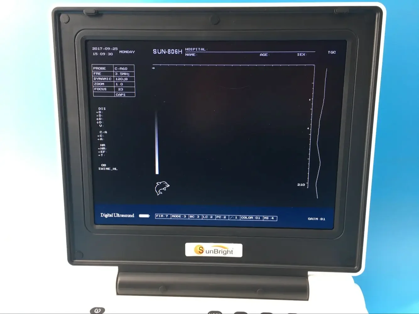 Portable LCD VET Digital portable Sunbright ultrasound for cow pregnancy SUN-806H