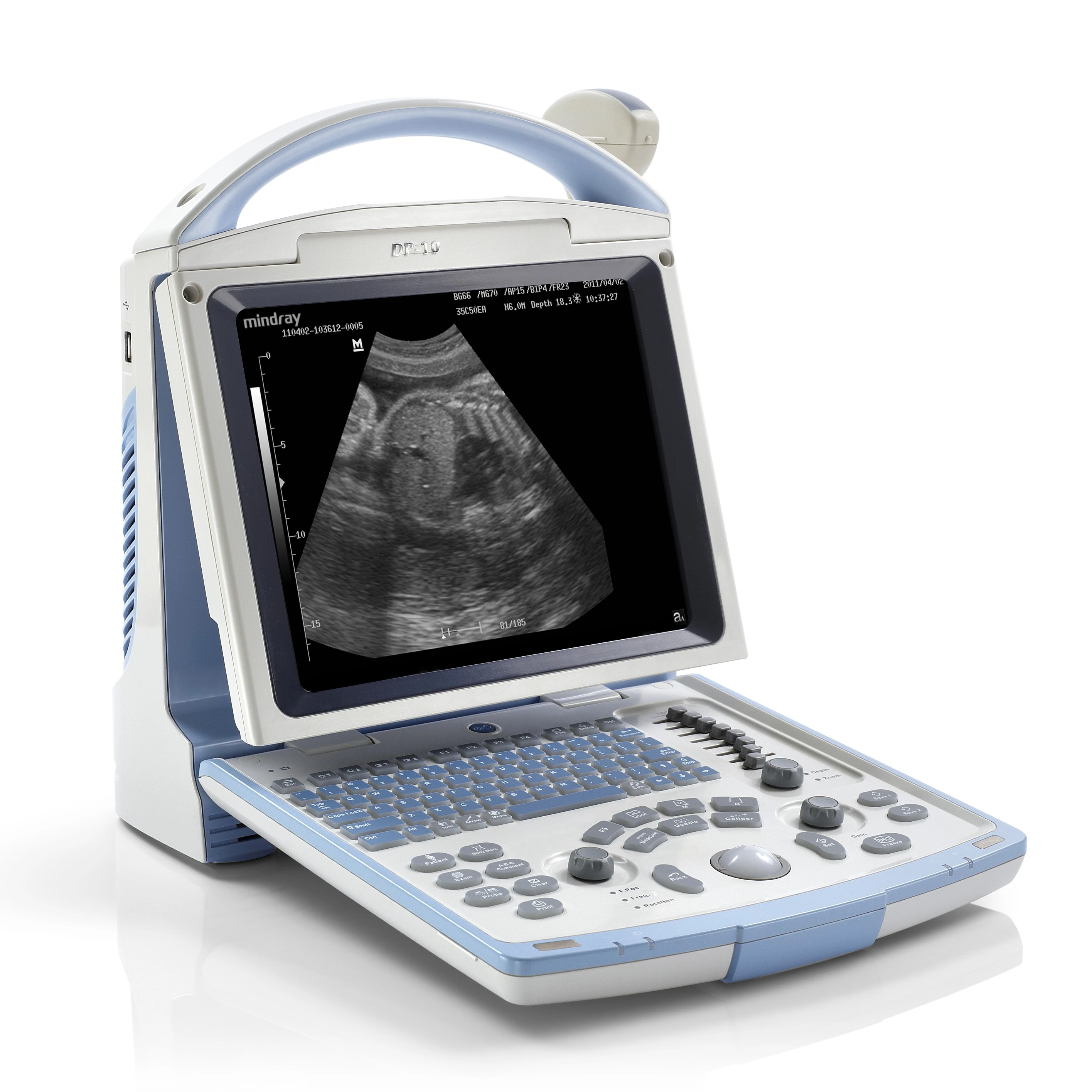 

Mindray DP-10 Ultrasound Machine Medical Sonography B-Ultrasound Machine With Abdominal Probe